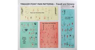 Triggerpoint Pain Patterns Wall Charts