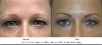 permanent makeup offers solution for