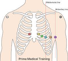 12 lead ecg placement guide
