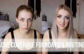 acne coverage foundation