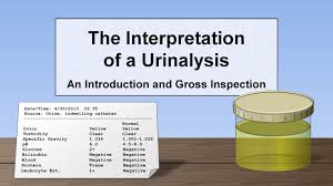 Interpretation Of The Urinalysis Part 1 Introduction And Inspection