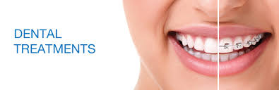 Image result for Dental Care
