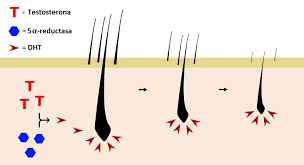 One study applied the extract to 4. Getting To Know The Hair Loss Process The Role Of The 5 Reductase Enzyme