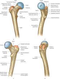 extracapsular proximal femur fractures