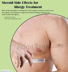 Steroid Side Effects For Allergy Treatment