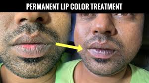 permanent lip color correction
