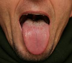 aaahhh tongue diagnosis in tcm