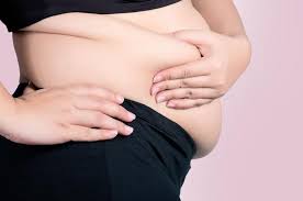 obesity and pelvic organ prolapse