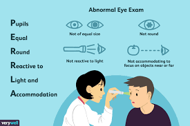 What To Expect When You Go For A Routine Eye Exam Eye Exam