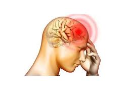 80%頭痛是精神緊張導致的，?但這幾種頭痛不要硬抗，可能威脅生命！ - 知乎