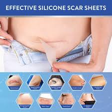 aroamas scar silicone scar sheets