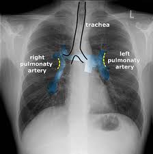 This imaging method can also check how a patient is responding to specific treatments. X Thorax Startradiology