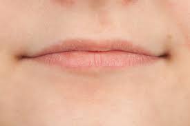 sunburned lips symptoms treatment