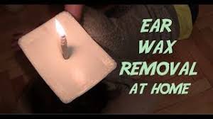 how to removing ear wax with candles