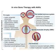 vivo gene therapy with aavs
