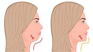 7 exercises that remove double chin