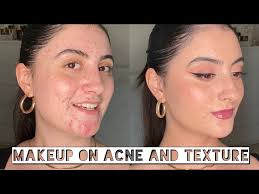 makeup application on acne and textured