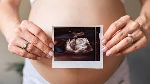 Karena menurutnya, bentuk perut hamilnya terkesan melebar, yang diyakini oleh masyarakat menunjukkan bayi perempuan. Cara Membaca Hasil Usg 2d Yang Ibu Hamil Perlu Pahami