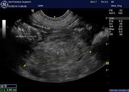idiopathic gastric ulceration in dogs