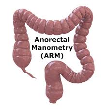leverage anorectal manometry arm