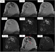 Google translate a personal interpreter on your phone or computer. Does Higher Field Strength Translate Into Better Diagnostic Accuracy A Prospective Comparison Of Breast Mri At 3 And 1 5 Tesla European Journal Of Radiology