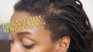 It is thus extremely beneficial in cases of temporary hair loss, making your hair shinier and stronger. Product Review Jamaican Black Castor Oil For Hairline Growth Youtube