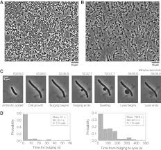 bacterial cell lysis