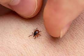 how to remove a tick head stuck in your