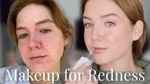 natural makeup to cover redness you