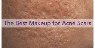 how to cover acne scars with makeup