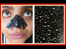 diy blackhead remover mask