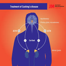 cur management of cushing s disease