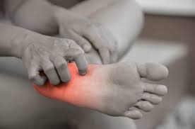 10 causes of itchy feet suffolk foot