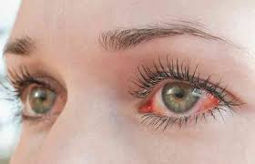 eye makeup tips for sensitive eyes