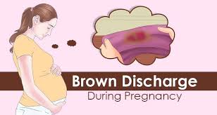 brown inal discharge during