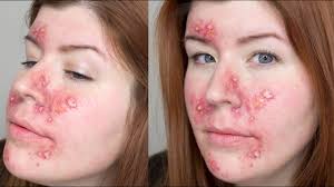 fx makeup series acne you