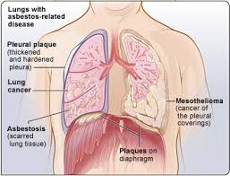 asbestos in safes and filing cabinets