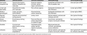 diffeial diagnosis of dermais