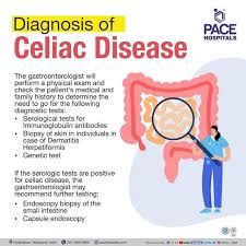 celiac disease symptoms causes risk