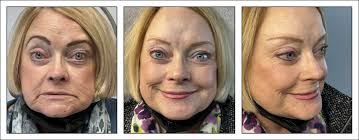 permanent makeup before after gallery