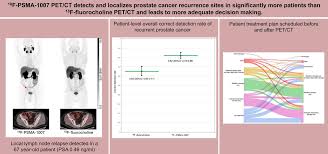 Cancer Biochemical Recurrence
