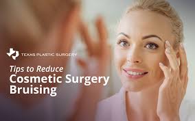 cosmetic surgery bruising