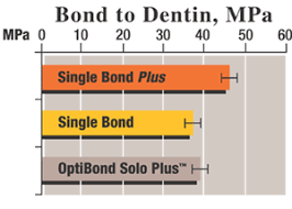 Adper Single Bond 2 Adhesive