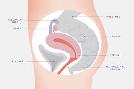 where is endometriosis pain areas of