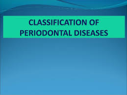 Classification Of Periodontal Diseases