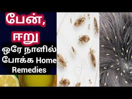 home remes for lice in tamil lice