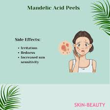 benefits of mandelic acid for your skin