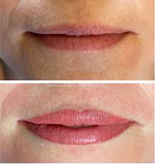 lip blushing cosmetic procedure