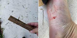 man steps on rusted nail in woodlands