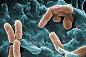 infeksi bakteri pseudomonas aeruginosa